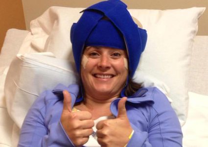 تبريد فروة الرأس يحمي مرضى السرطان من فقدان الشعر