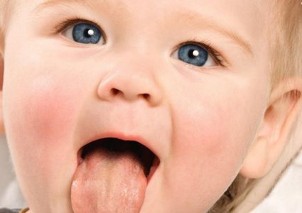 لون اللسان ... علامة صحية