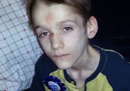 قرار غريب لعائلة تركت طفلها ليفترسه الموت وحيدا