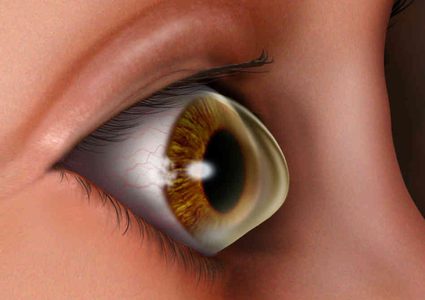 زرع قرنية لطفل من عيني خنزير بنجاح