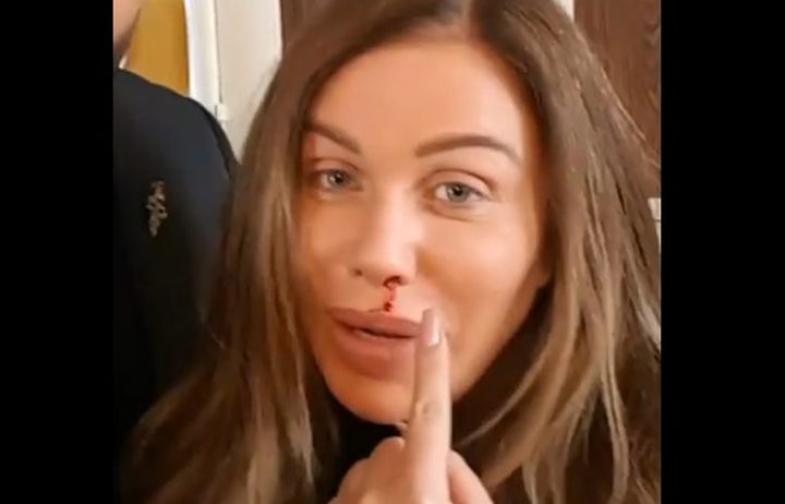 باسم ياخور يضرب نيكول سابا والدم يسيل من أنفها! (فيديو)