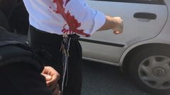 مستوطن يدعي تعرضه للطعن غرب بيت لحم
