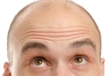 الرجل القصير أكثر عرضة للصلع!