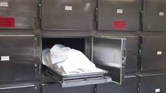 مصرع ممرضة اسرائيلية بمادة مشتعلة