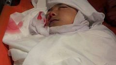 مصرع طفل نتيجة سقوط حجر عليه