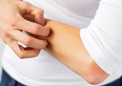 هل الشعور بالحكة معدي أم لا ؟