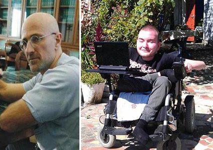 تحديد موعد زراعة أول رأس في العالم