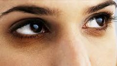 أسباب الهالات السوداء وطرق علاجها