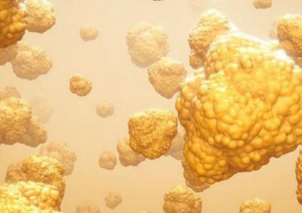 دراسة امريكية: السمنة تحفز الخلايا السرطانية