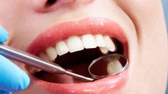 علماء يطورون حشوات أسنان دائمة وخارقة