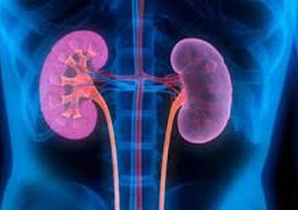 150 مليون مريض بالتهابات المسالك البولية سنويا بالعالم