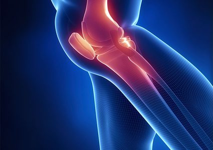 طباعة ناجحة لغضروف اصطناعي لمفصل الركبة