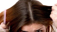 علاج إلتهابات فروة الرأس بطرق طبيعية