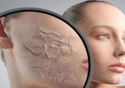 ماذا يفعل الجفاف فى جسم الإنسان؟