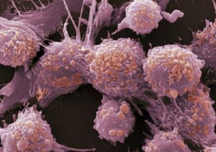 إختبار دم لتحديد العلاج الأفضل لكل مريض بسرطان البروستات