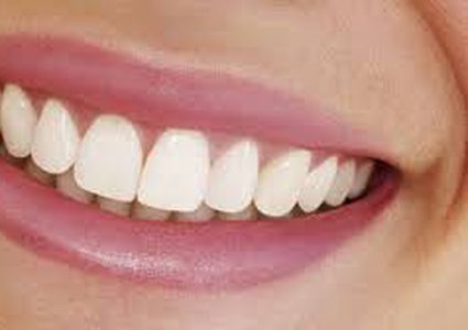 آثار خطرة لتسوس الأسنان