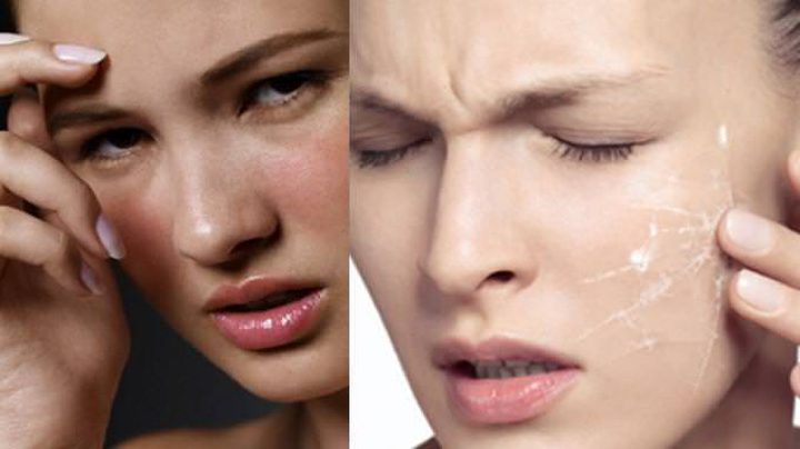 تجنبي هذه الأطعمة لصاحبات البشرة الحساسة