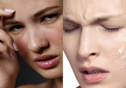 تجنبي هذه الأطعمة لصاحبات البشرة الحساسة