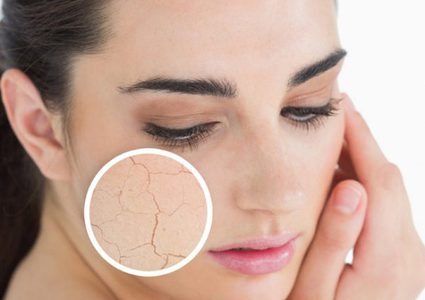 كيف تتخلصين من جفاف البشرة؟