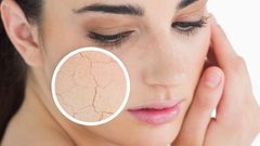 كيف تتخلصين من جفاف البشرة؟