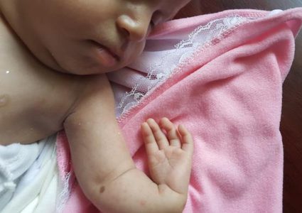 أسلحة إسرائيلية محرَّمة دولياً.. فتكت بمواليد غزة