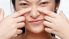 كيف تحاربين الرؤوس السوداء؟