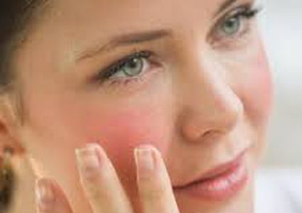 خلطات تخفف حساسية البشرة