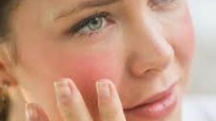 خلطات تخفف حساسية البشرة