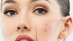 خلطات لعلاج بقع الوجه وإزالتها