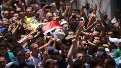 استشهاد مواطن من طولكرم متأثراً بإصابته (صور)