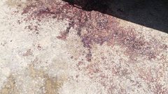 مقتل مواطن وإصابة أخر جراء شجار في قلقيلية (صور)