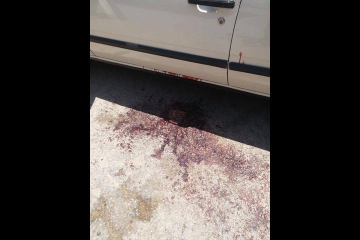 مقتل مواطن وإصابة أخر جراء شجار في قلقيلية (صور)