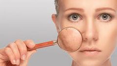 كيف تتخلصين من المسام الواسعة للبشرة؟