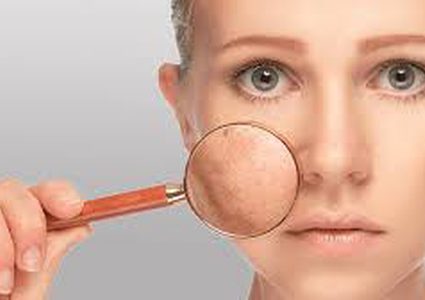 كيف تتخلصين من المسام الواسعة للبشرة؟