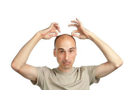 طول القامة ولون البشرة يتحكمان في الصلع