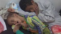 الصحة العالمية: (100) الف مصاب بالكوليرا في اليمن