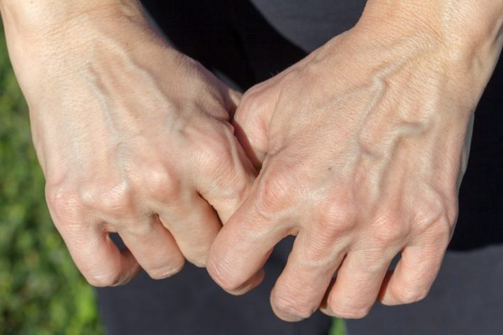 لماذا تظهر عروقنا زرقاء في حين أن الدم أحمر اللون؟