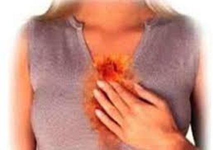 "ستريتا"  طريقة جديدة لعلاج الحموضة