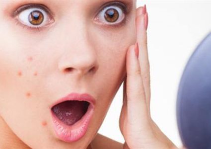 عادات يومية تخلصك من حبوب البشرة