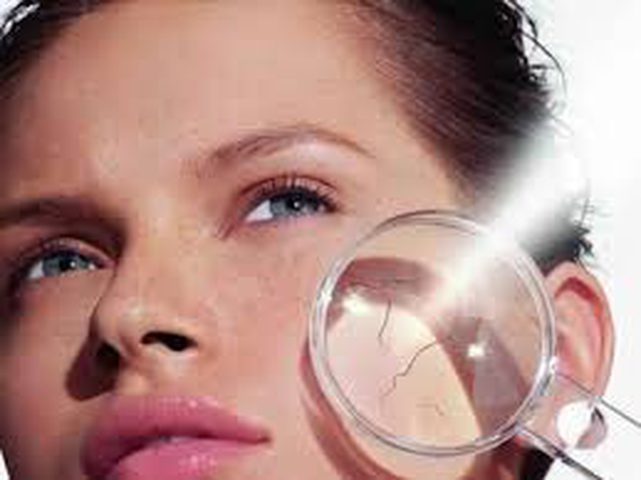 أفضل طرق علاج حروق الشمس