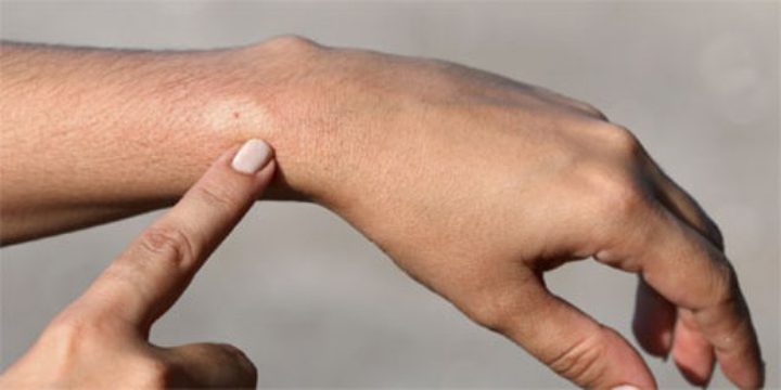 حشرة سوداء غير معروفة تثير رعب السكان