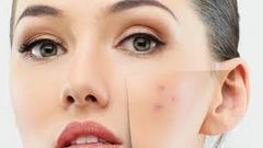 خطوات للتخلص من البقع الداكنة بالمكياج