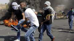 36 إصابة خلال مواجهات بالعيزرية(فيديو)