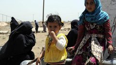 يونيسف: معونات طبية لعلاج اطفال اليمن المصابين بسوء التغذية