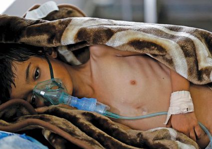 الصحة العالمية: أكثر من 600 ألف إصابة بالكوليرا باليمن