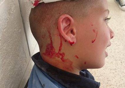 بلاونة يوضح لـ"النجاح" تفاصيل اصابة طالب بمدرسة في نابلس الاسبوع الماضي