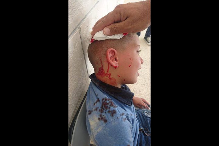 بلاونة يوضح لـ"النجاح" تفاصيل اصابة طالب بمدرسة في نابلس الاسبوع الماضي