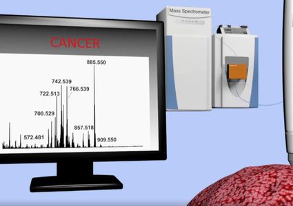 قلم يكشف الخلايا السرطانية في 10 ثوان