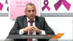 أسباب ظهور الدوالي العنكبوتية ؟
