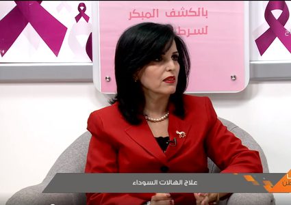 علاج الهالات السوداء